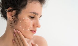 Combien de temps faut-il réellement pour réparer une barrière cutanée endommagée